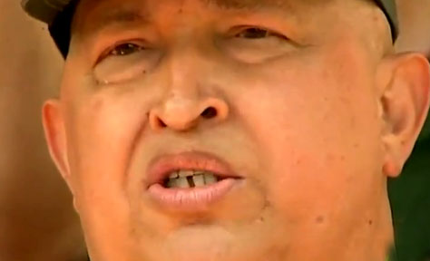 Presidente Chávez será operado en Cuba esta semana